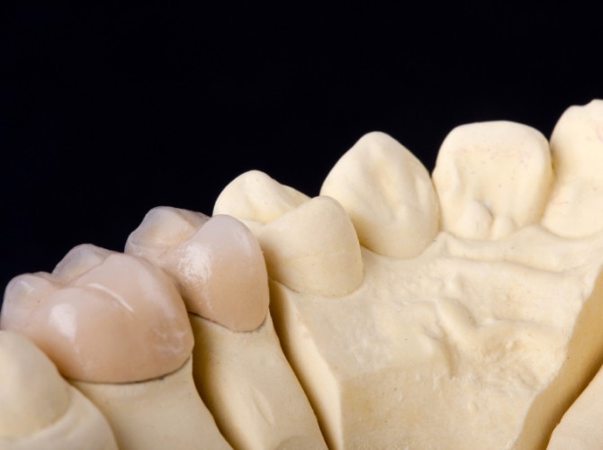 detail dental wax model